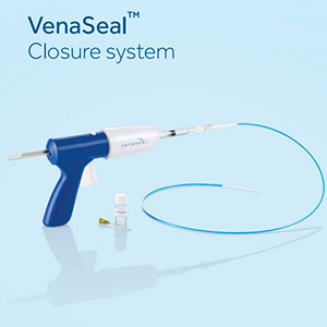 Venaseal Glue treatment for veins